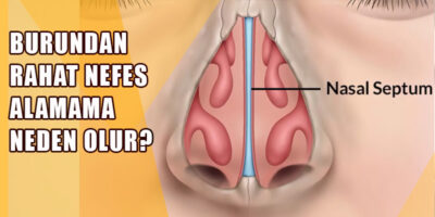 Burundan Rahat Nefes Alamama Neden Olur?